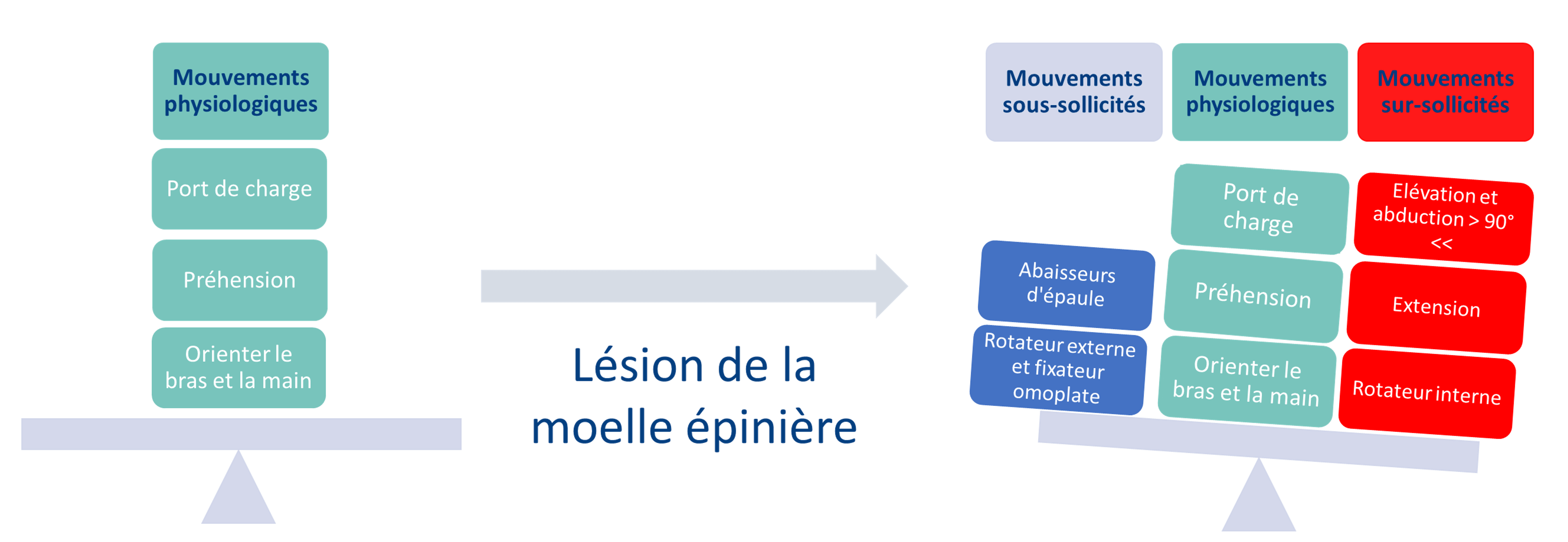 L&eacute;sion de la moelle &eacute;pini&egrave;re