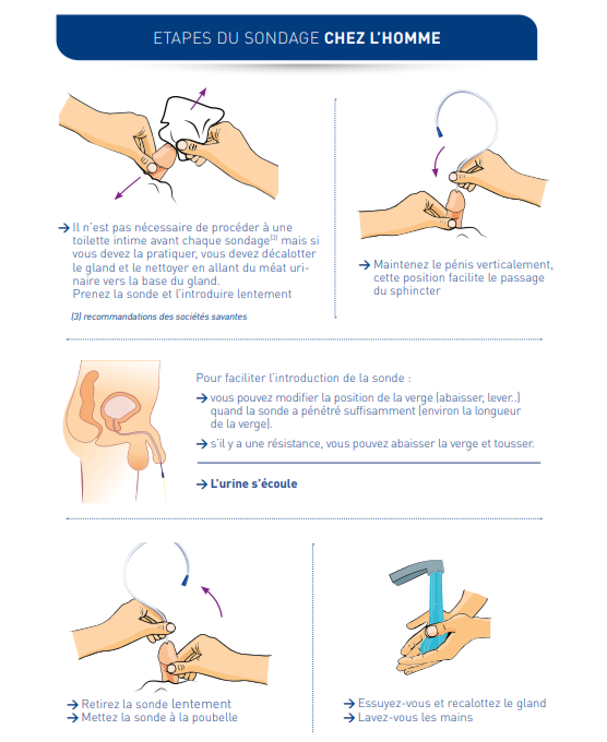 Etape sondage chez la femme