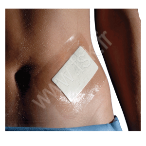 Pansement Tegaderm Pad