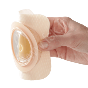 Support Natura Modelable Soufflet Stoma Stomie Digestive
