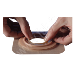 Support Natura Modelable Soufflet Stoma Stomie Digestive