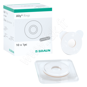 Anneaux Ally