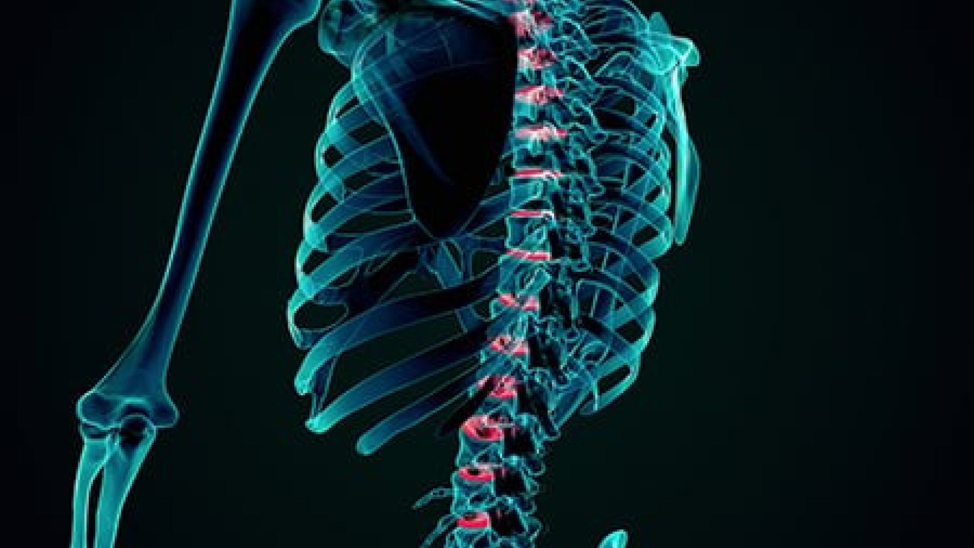 Une colonne vert&eacute;brale, trois r&eacute;gions, connaissez-vous les diff&eacute;rences en ce qui concerne les l&eacute;sions m&eacute;dullaires ?